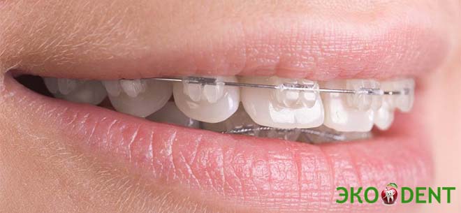 Стоматология Эко&nbsp;Dent